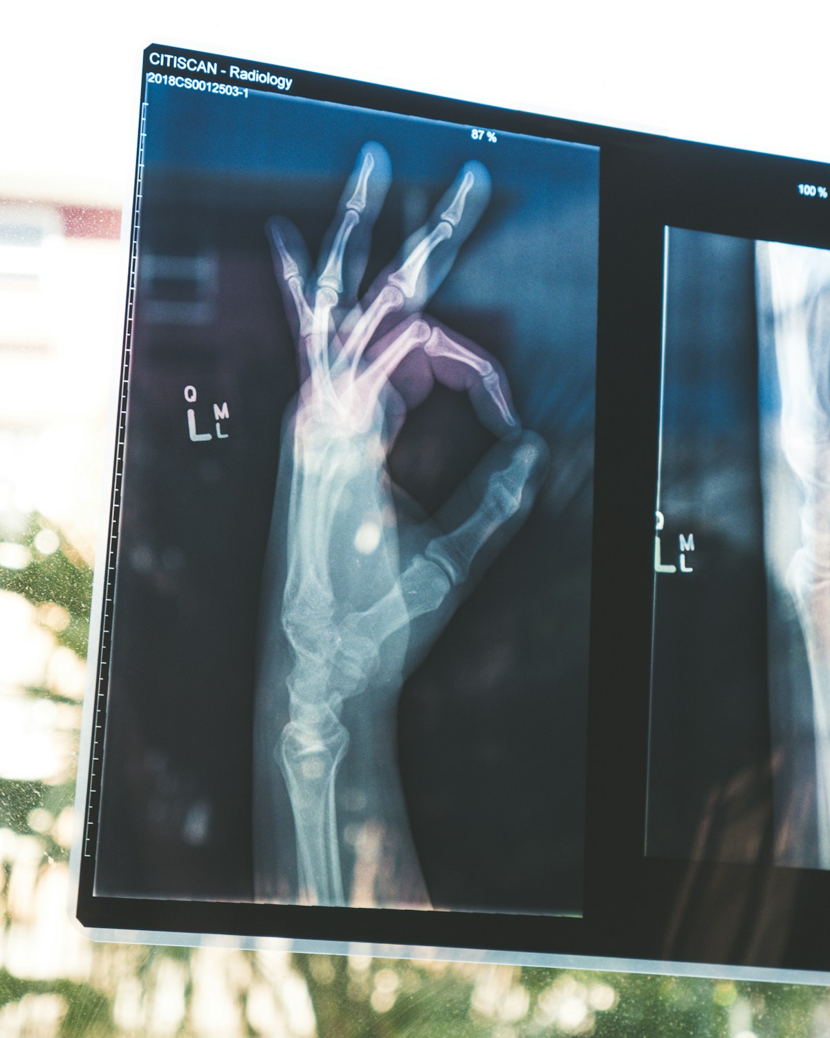 Modern hospital technology and patient care systems